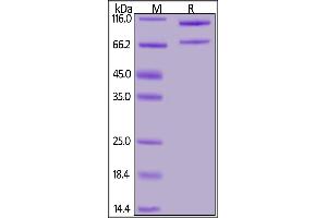 SDS-PAGE (SDS) image for Complement Component 5 (C5) (AA 19-1680) (Active) protein (His tag) (ABIN7013368)