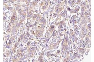 Immunohistochemistry (IHC) image for anti-Src-Related Kinase Lacking C-Terminal Regulatory Tyrosine and N-Terminal Myristylation Sites (SRMS) (C-Term) antibody (ABIN6259481)