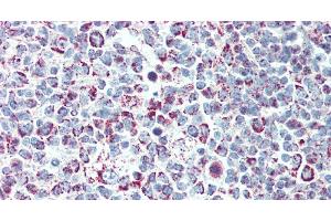 Immunohistochemistry of paraffin-embedded Tonsil tissue using LTB Polyclonal Antibody at dilution of 1:90. (LTB 抗体)