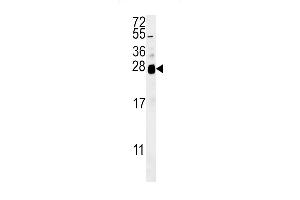 ZN Antibody (C-term) (ABIN651881 and ABIN2840437) western blot analysis in  cell line lysates (35 μg/lane). (RNF114 抗体  (C-Term))