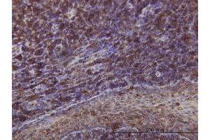 Immunoperoxidase of monoclonal antibody to EMD on formalin-fixed paraffin-embedded human tonsil. (Emerin 抗体  (AA 1-110))