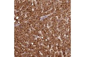 Immunohistochemical staining of human liver with C16orf46 polyclonal antibody  shows strong cytoplasmic positivity in hepatocytes. (C16ORF46 抗体)