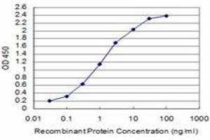 Detection limit for recombinant GST tagged SIX4 is approximately 0. (SIX4 抗体  (AA 672-780))