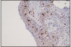 Immunohistochemistry (IHC) image for anti-CD1a (CD1a) (C-Term) antibody (ABIN870503) (CD1a 抗体  (C-Term))