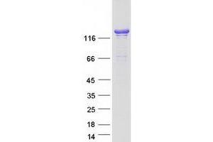 Western Blotting (WB) image for Histocompatibility (Minor) HA-1 (HMHA1) protein (Myc-DYKDDDDK Tag) (ABIN2722885)