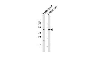 All lanes : Anti-SLC30A10 Antibody (C-term) at 1:2000 dilution Lane 1: human fetal brain lysate Lane 2: human fetal liver lysate Lysates/proteins at 20 μg per lane. (SLC30A10 抗体  (AA 331-359))