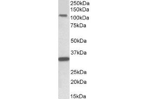 ABIN2561660 (1µg/ml) staining of Human Hippocampus lysate (35µg protein in RIPA buffer). (KIT 抗体  (Internal Region))