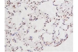 ABIN6267354 at 1/200 staining Rat lung tissue sections by IHC-P.