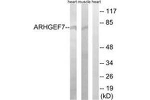 Western blot analysis of extracts from rat muscle/rat heart cells, using ARHGEF7 Antibody. (ARHGEF7 抗体  (AA 311-360))