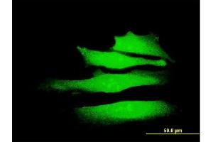 Immunofluorescence of monoclonal antibody to SMARCA2 on HeLa cell.