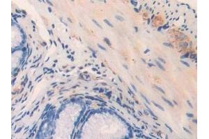Immunohistochemistry (IHC) image for anti-Myosin, Light Chain 3 (MYL3) (AA 8-199) antibody (ABIN7443521)