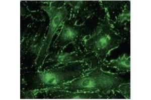 Immunostaining of primary RPE cells With CX43 Ab  at 1/100 dilution. (Connexin 43/GJA1 抗体  (C-Term))