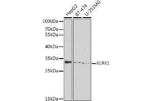 Western Blotting (WB) image for anti-Killer Cell Lectin-Like Receptor Subfamily K, Member 1 (KLRK1) (AA 77-216) antibody (ABIN6142979)