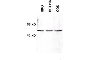 Image no. 1 for anti-Checkpoint Kinase 1 (CHEK1) (AA 1-474) antibody (ABIN264916) (CHEK1 抗体  (AA 1-474))