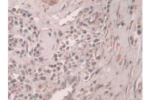 Immunohistochemistry (IHC) image for anti-serpin Peptidase Inhibitor, Clade A (Alpha-1 Antiproteinase, Antitrypsin), Member 5 (SERPINA5) (AA 43-406) antibody (ABIN7435505)