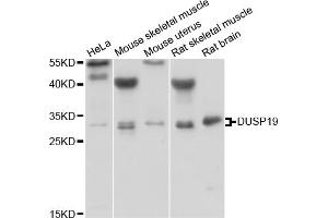 Western blot analysis of extracts of various cell lines, using DUSP19 antibody (ABIN1882354) at 1:1000 dilution. (DUSP19 抗体)