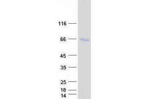 Western Blotting (WB) image for Spermatogenesis Associated 18 (SPATA18) protein (Myc-DYKDDDDK Tag) (ABIN2732514)