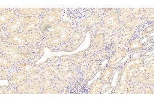 Immunohistochemistry (IHC) image for anti-Meningioma Expressed Antigen 5 (Hyaluronidase) (MGEA5) (AA 6-240) antibody (ABIN7430753)