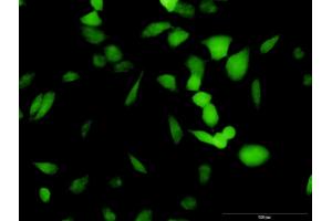 Immunofluorescence of purified MaxPab antibody to PA2G4 on HeLa cell. (PA2G4 抗体  (AA 1-394))