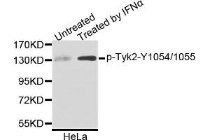 Western blot analysis of extracts of HeLa cells, using Phospho-Tyk2-Y1054/1055 antibody. (TYK2 抗体)