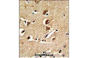 Formalin-fixed and raffin-embedded human brain tissue reacted with GNT Antibody (C-term), which was peroxidase-conjugated to the secondary antibody, followed by DAB staining. (GNPAT 抗体  (C-Term))