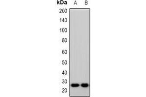 Western blot analysis of IMP3 expression in Hela (A), HepG2 (B) whole cell lysates. (IMP3 抗体  (C-Term))