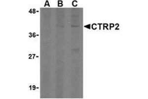 Western blot analysis of CTRP2 in 3T3 (Balb) cell lysate with AP30248PU-N CTRP2 (IN) antibody at (A) 1, (B) 2, and (C) 4 μg/ml. (C1QTNF2 抗体  (Intermediate Domain))
