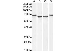Western Blotting (WB) image for anti-Acetylcholinesterase (AChE) (C-Term) antibody (ABIN185357)