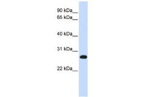 SNAP23 antibody used at 1 ug/ml to detect target protein. (SNAP23 抗体  (N-Term))