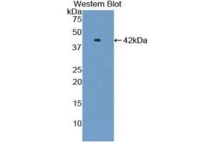 WB of Protein Standard: different control antibodies against Highly purified E. (VTCN1 ELISA 试剂盒)