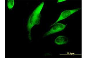 Immunofluorescence of purified MaxPab antibody to FKBP4 on HeLa cell.