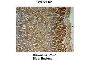 Sample Type : Monkey adrenal gland  Primary Antibody Dilution :  1:25  Secondary Antibody: Anti-rabbit-HRP  Secondary Antibody Dilution:  1:1000  Color/Signal Descriptions: Brown: CYP21A2 Blue: Nucleus  Gene Name: CYP21A2  Submitted by: Jonathan Bertin, Endoceutics Inc. (CYP21A2 抗体  (C-Term))