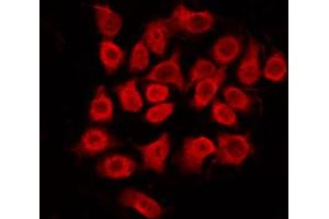 ABIN6272438 staining HepG2 by IF/ICC. (SS18 抗体  (N-Term))