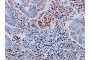 Immunohistochemistry (IHC) image for anti-Vimentin (VIM) antibody (ABIN7426163)