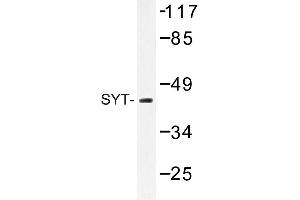 Image no. 1 for anti-Synaptotagmin I (SYT1) antibody (ABIN272235) (SYT1 抗体)