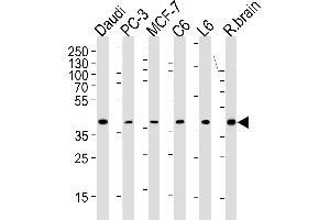 CREB3L4 Antibody (M01) (ABIN1882047 and ABIN2838479) western blot analysis in Daudi,PC-3,MCF-7,rat C6 and L6 cell line ,rat brain tissue lysates (35 μg/lane). (CREB3L4 抗体  (AA 1-300))