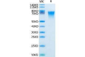 Mouse BSPII on Tris-Bis PAGE under reduced condition. (IBSP Protein (AA 17-324) (His tag))