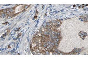 ABIN6277086 at 1/100 staining Human prostate tissue by IHC-P. (PDE1B 抗体  (C-Term))