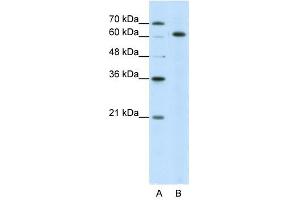 SNRP70 antibody used at 5 ug/ml to detect target protein. (SNRNP70 抗体)