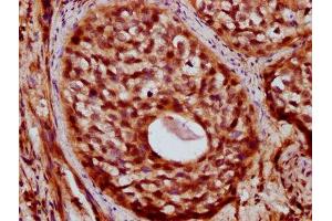 Immunohistochemistry (IHC) image for anti-Zinc Finger CCCH-Type Containing 14 (ZC3H14) (AA 176-306) antibody (ABIN7176036)