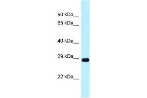 WB Suggested Anti-Dram1 Antibody Titration: 1. (DRAM 抗体  (N-Term))
