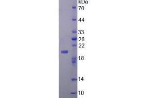 SDS-PAGE analysis of Mouse FGF22 Protein. (FGF22 蛋白)