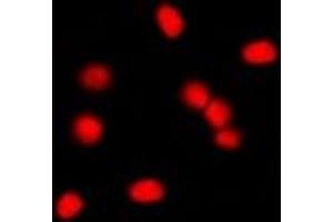 Immunofluorescent analysis of MDM2 staining in NIH3T3 cells. (MDM2 抗体)