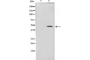 Western blot analysis of c-Jun phosphorylation expression in UV treated HeLa whole cell lysates,The lane on the left is treated with the antigen-specific peptide. (C-JUN 抗体  (pSer243))