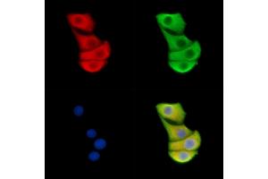 ABIN6262399 and ABIN6278869 staining Hela cells by IF/ICC. (HSPA9 抗体  (C-Term))