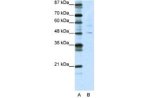 WB Suggested Anti-PLAGL1  Antibody Titration: 5. (PLAGL1 抗体  (N-Term))