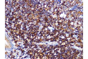 Immunohistochemistry (IHC) image for anti-Phosphoinositide 3 Kinase, p85 alpha (PI3K p85a) antibody (ABIN7269319)