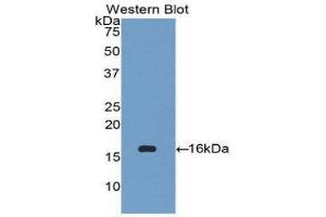 Western Blotting (WB) image for anti-Chemokine (C-C Motif) Ligand 27 (CCL27) (AA 25-112) antibody (ABIN1174874)