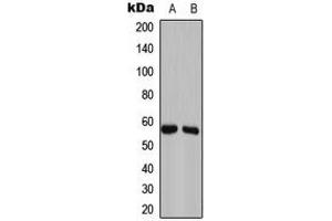 Western blot analysis of GAS8 expression in Caco2 (A), NIH3T3 (B) whole cell lysates. (GAS8 抗体  (Center))
