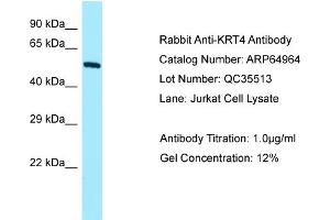 Western Blotting (WB) image for anti-Keratin 4 (KRT4) (N-Term) antibody (ABIN2790009) (KRT4 抗体  (N-Term))